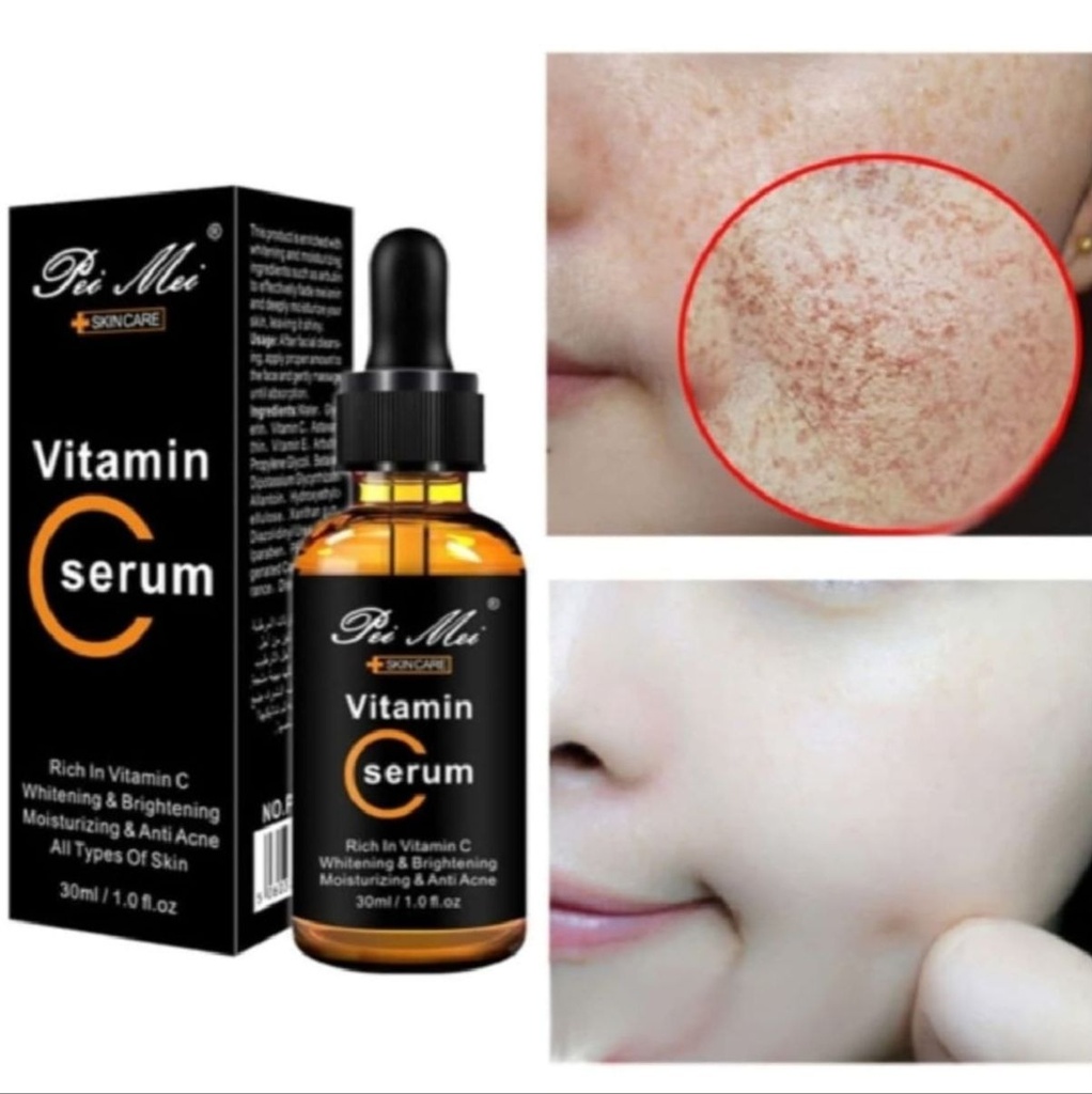 Pei Mei Vitamin C Moisturizing & Anti-Acne Face Serum - 30ml 